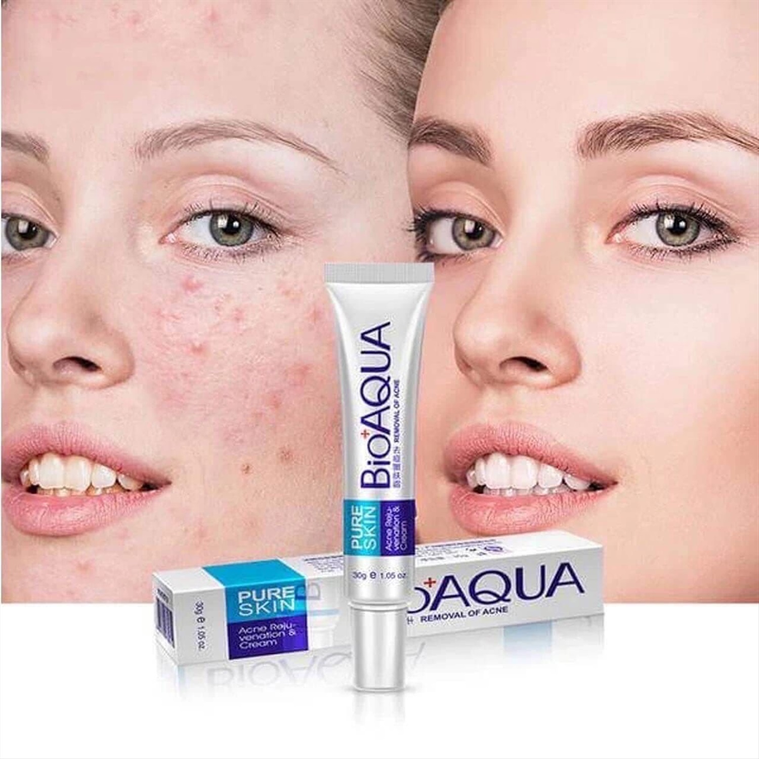 Bioaqua pure. Крем анти-акне BIOAQUA. Крем БИОАКВА removal of acne. БИОАКВА акне Ремовал. Крем от прыщей и акне BIOAQUA.