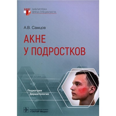 Акне у подростков. Самцов А.В.