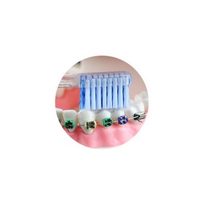 Ортодонтическая зубная нано щетка, 2 шт